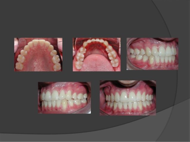 Universal LED Flash Ring 40 LEDS for Dental Photography – Dentistry World