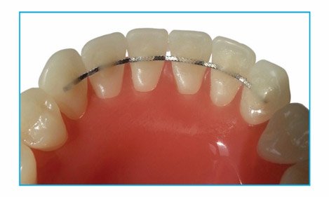 DentalStores in Buy Dental Products Online At Best Price